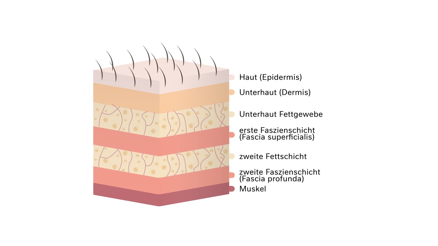 Haut Schaubild