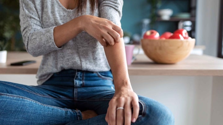 person kratzt sich am arm