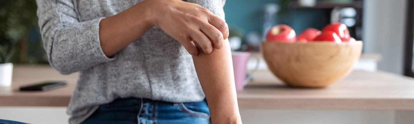 person kratzt sich am arm